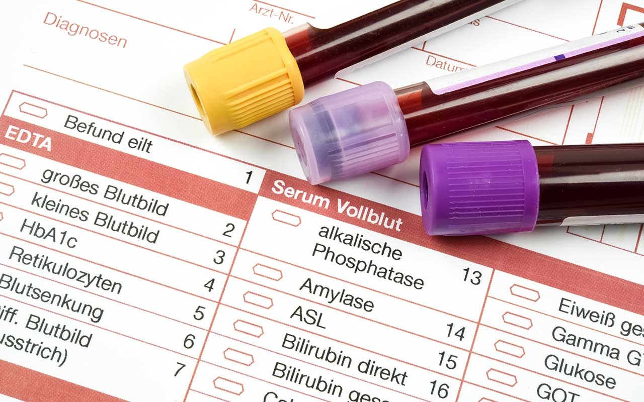 Labordiagnostik Internistische Facharztpraxis im Medicum Böblingen